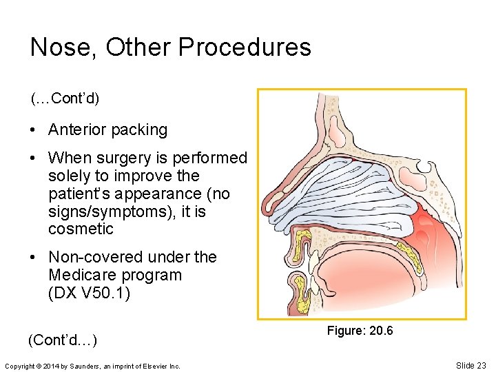 Nose, Other Procedures (…Cont’d) • Anterior packing • When surgery is performed solely to