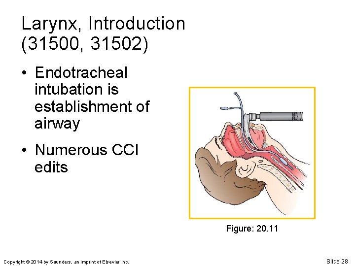 Larynx, Introduction (31500, 31502) • Endotracheal intubation is establishment of airway • Numerous CCI