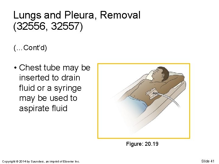 Lungs and Pleura, Removal (32556, 32557) (…Cont’d) • Chest tube may be inserted to