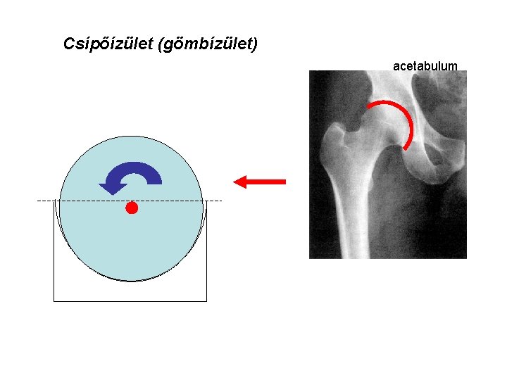 Csípőízület (gömbízület) acetabulum 