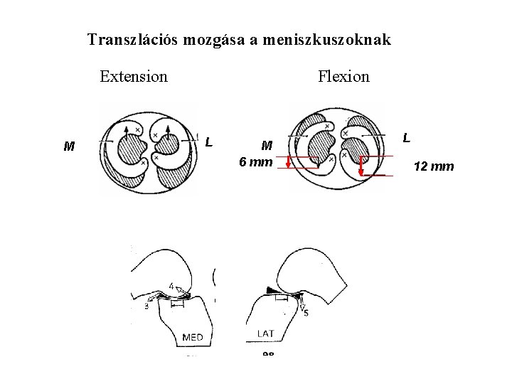 Transzlációs mozgása a meniszkuszoknak Extension M Flexion L M 6 mm L 12 mm