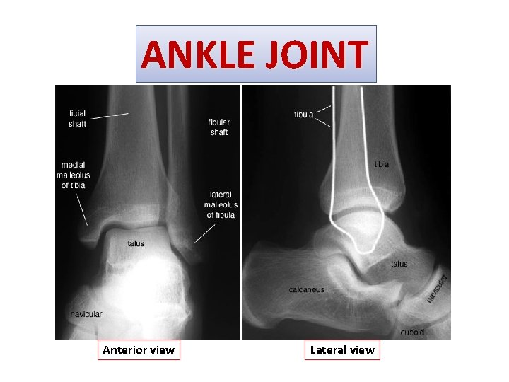 ANKLE JOINT Anterior view Lateral view 