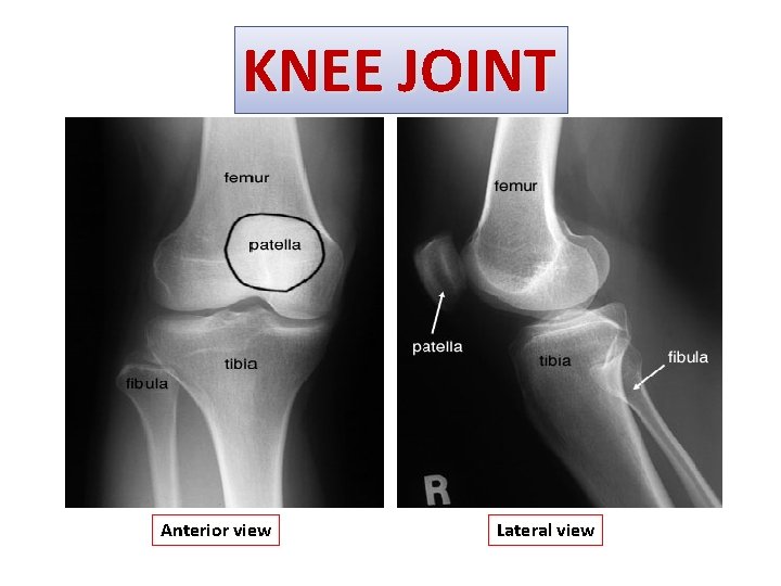 KNEE JOINT Anterior view Lateral view 