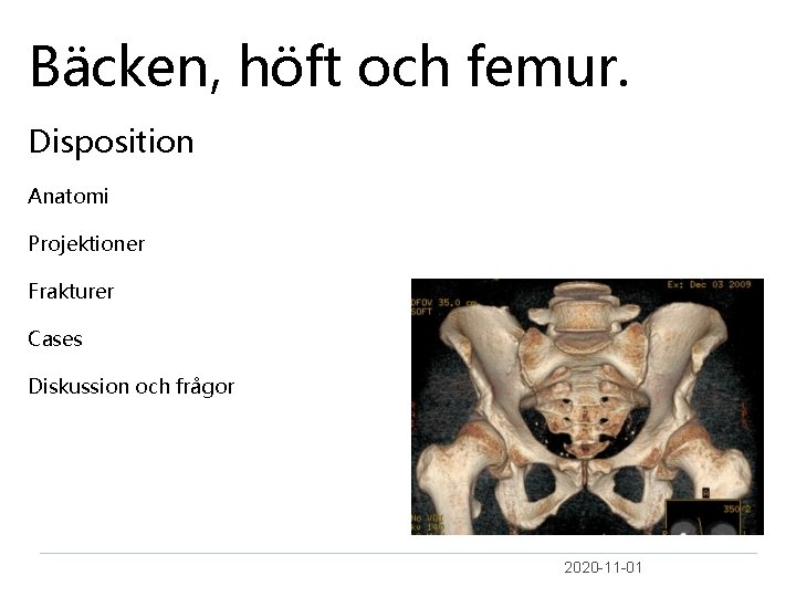 Bäcken, höft och femur. Disposition Anatomi Projektioner Frakturer Cases Diskussion och frågor 2020 -11