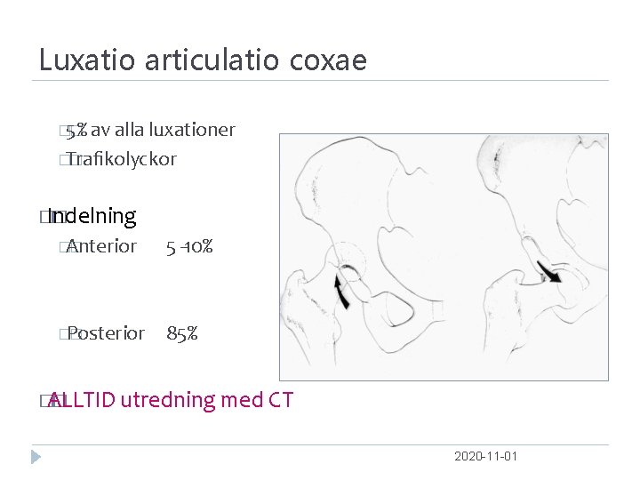 Luxatio articulatio coxae � 5% � av alla luxationer �Traﬁkolyckor � � Indelning �