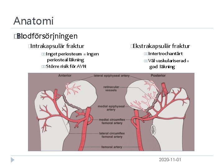 Anatomi � Blodförsörjningen � �Intrakapsulär � fraktur Inget periosteum = ingen periosteal läkning Större