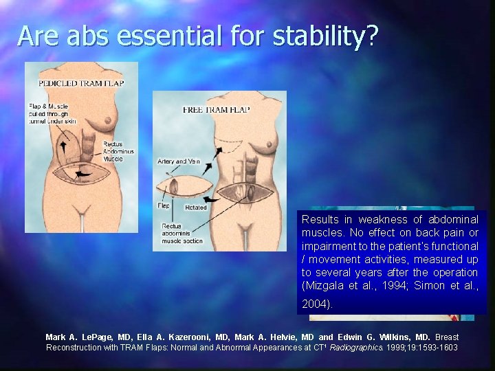 Are abs essential for stability? Results in weakness of abdominal muscles. No effect on