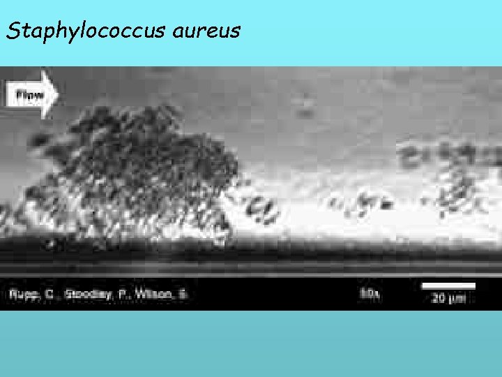 Staphylococcus aureus 