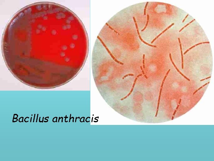 Bacillus anthracis 