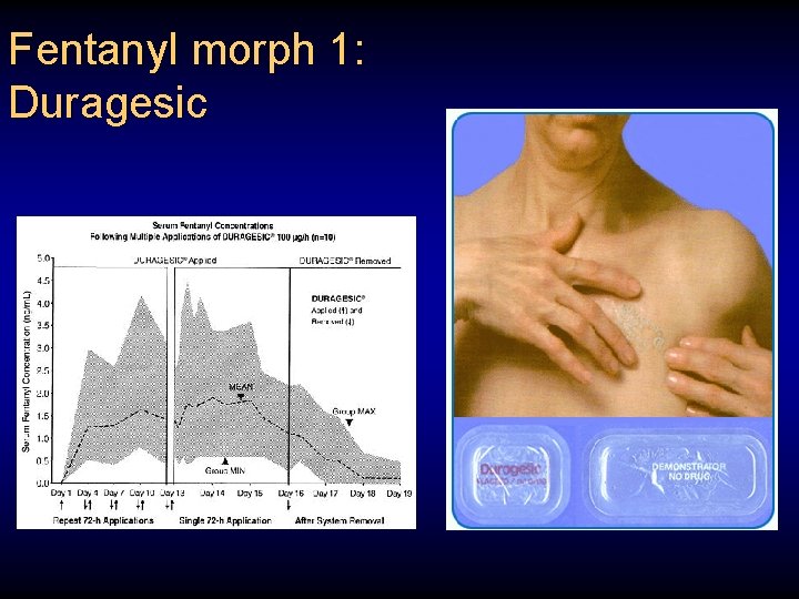 Fentanyl morph 1: Duragesic 