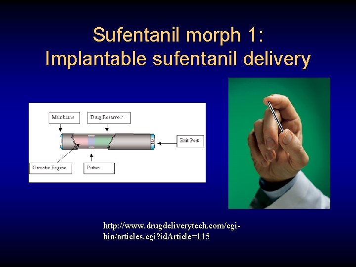 Sufentanil morph 1: Implantable sufentanil delivery http: //www. drugdeliverytech. com/cgibin/articles. cgi? id. Article=115 