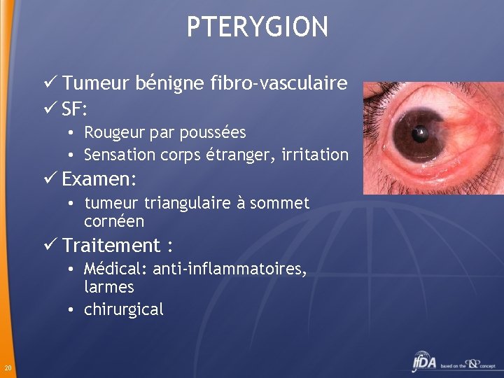 PTERYGION ü Tumeur bénigne fibro-vasculaire ü SF: • Rougeur par poussées • Sensation corps