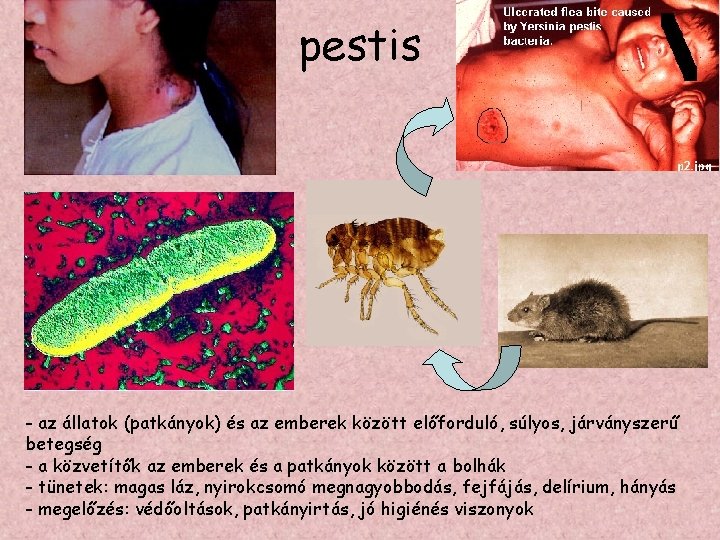 pestis - az állatok (patkányok) és az emberek között előforduló, súlyos, járványszerű betegség -