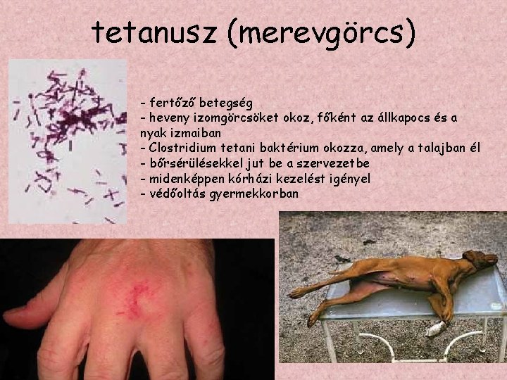 tetanusz (merevgörcs) - fertőző betegség - heveny izomgörcsöket okoz, főként az állkapocs és a