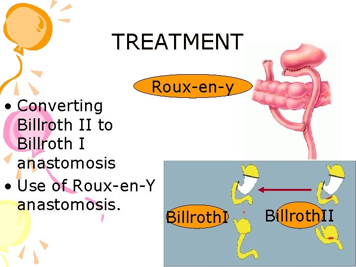 TREATMENT Roux-en-y • Converting Billroth II to Billroth I anastomosis • Use of Roux-en-Y
