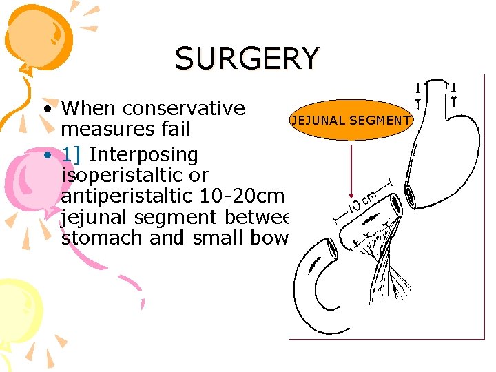 SURGERY • When conservative JEJUNAL SEGMENT measures fail • 1] Interposing isoperistaltic or antiperistaltic