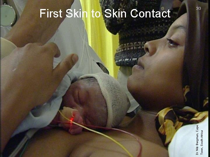 Town, South Africa Dr Nils Bergman, Cape First Skin to Skin Contact 5/3 