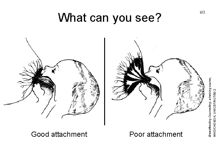 Good attachment Poor attachment WHO/CHD/93. 4, UNICEF/NUT/93. 2 Breastfeeding Counselling: a training course, What