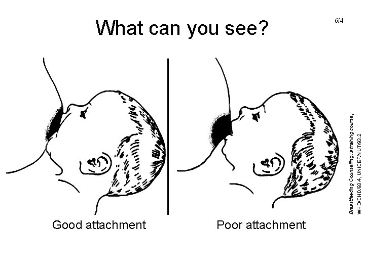 Good attachment Poor attachment WHO/CHD/93. 4, UNICEF/NUT/93. 2 Breastfeeding Counselling: a training course, What