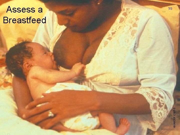 7/3 ©UNICEF C 107 -5 Assess a Breastfeed 