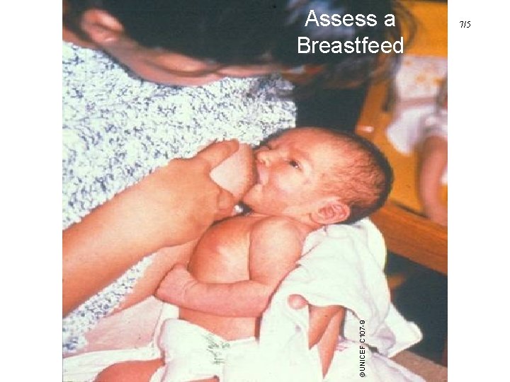©UNICEF C 107 -9 Assess a Breastfeed 7/5 