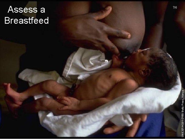 UNICEF/HQ 91 -0168/ Betty Press, Kenya Assess a Breastfeed 7/6 