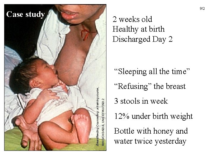 9/2 Case study 2 weeks old Healthy at birth Discharged Day 2 3 stools