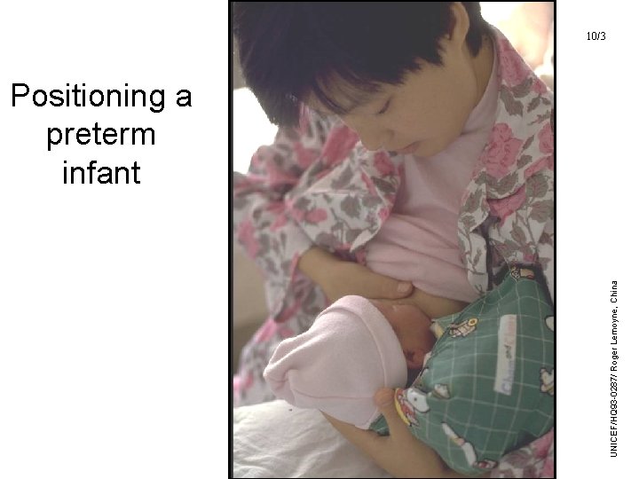 UNICEF/HQ 93 -0287/ Roger Lemoyne, China 10/3 Positioning a preterm infant 