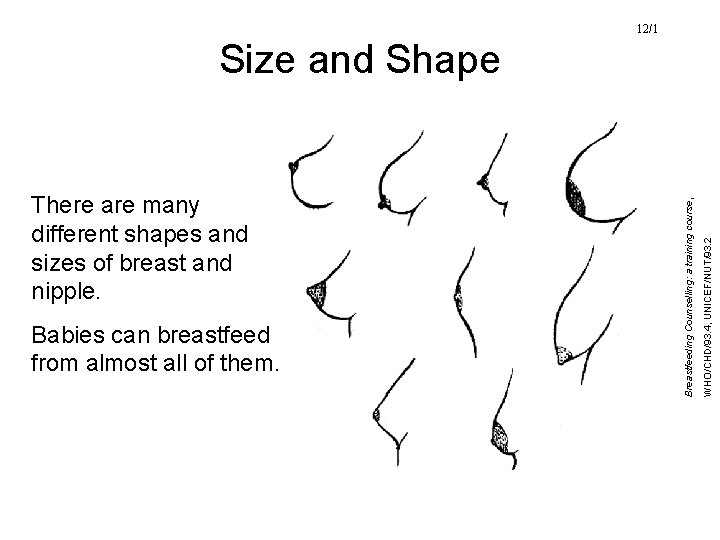 12/1 Babies can breastfeed from almost all of them. WHO/CHD/93. 4, UNICEF/NUT/93. 2 There