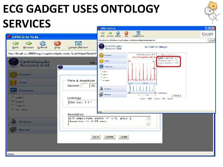 ECG GADGET USES ONTOLOGY SERVICES 