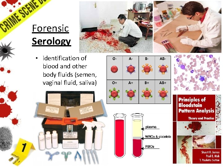 Forensic Serology • identification of blood and other body fluids (semen, vaginal fluid, saliva) Forensic Serology • identification of blood and other body fluids (semen, vaginal fluid, saliva)