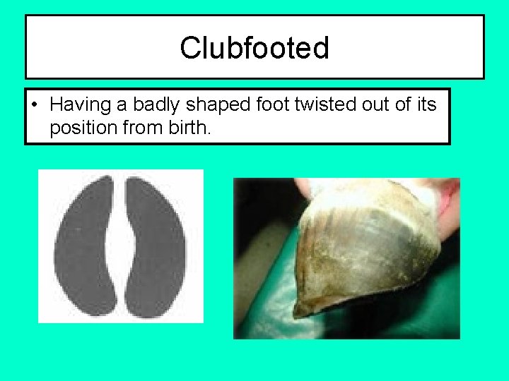 Clubfooted • Having a badly shaped foot twisted out of its position from birth.