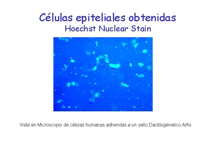 Células epiteliales obtenidas Hoechst Nuclear Stain Vista en Microscopio de células humanas adheridas a