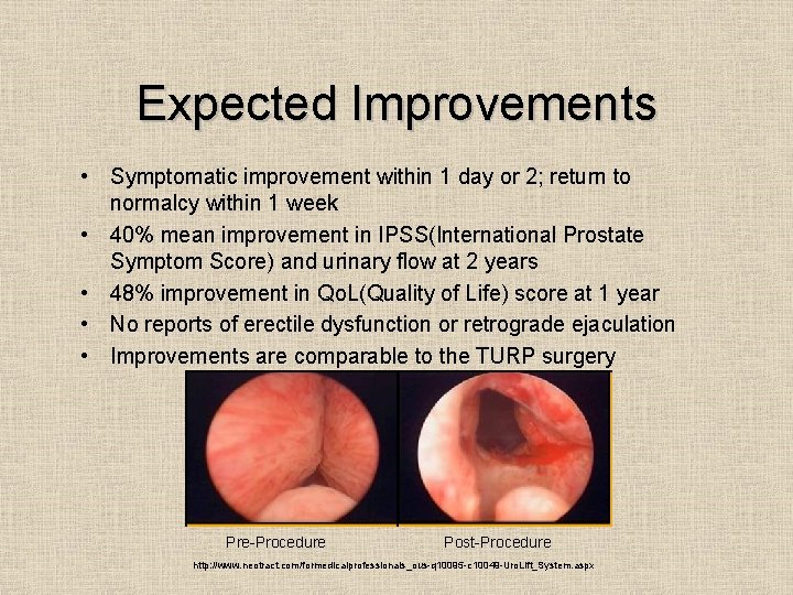 Expected Improvements • Symptomatic improvement within 1 day or 2; return to normalcy within