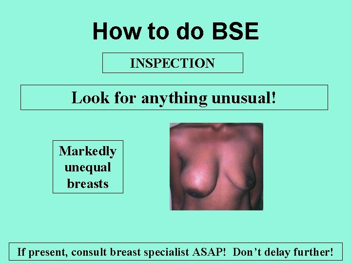 How to do BSE INSPECTION Look for anything unusual! Markedly unequal breasts If present,