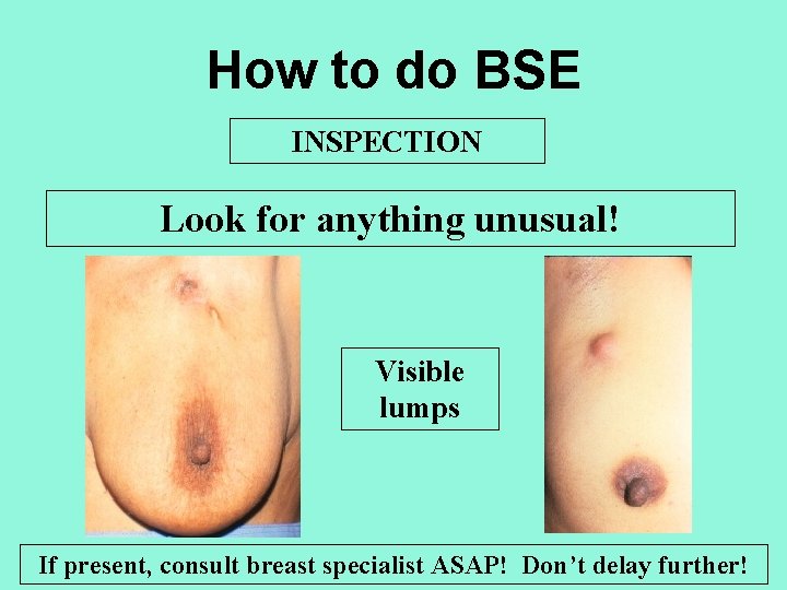 How to do BSE INSPECTION Look for anything unusual! Visible lumps If present, consult