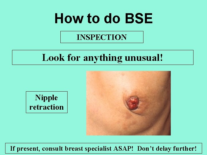 How to do BSE INSPECTION Look for anything unusual! Nipple retraction If present, consult