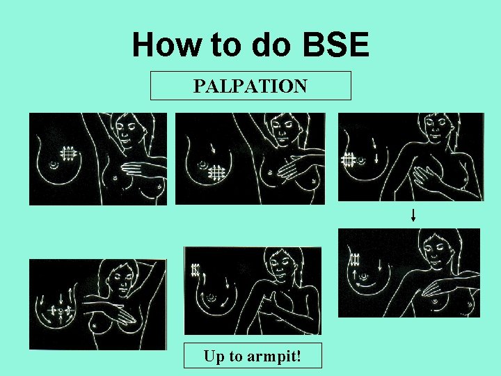 How to do BSE PALPATION Up to armpit! 