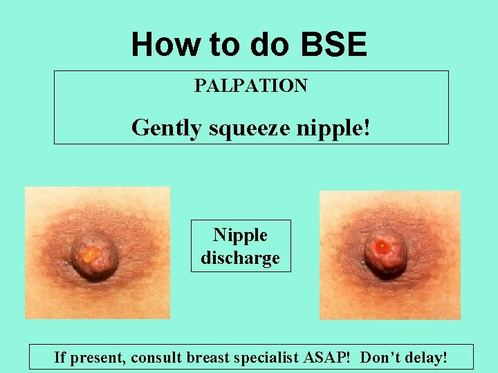 How to do BSE PALPATION Gently squeeze nipple! Nipple discharge If present, consult breast