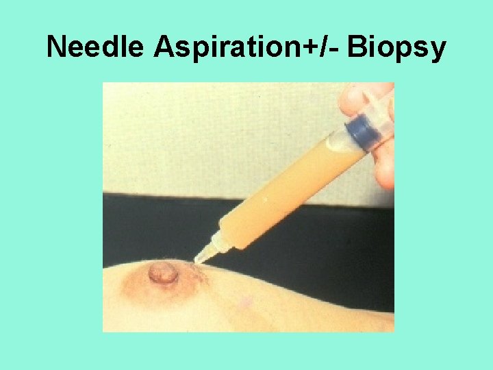 Needle Aspiration+/- Biopsy 