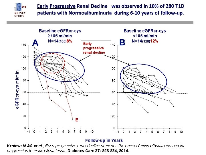 Krolewski AS et al. , Early progressive renal decline precedes the onset of microalbuminuria