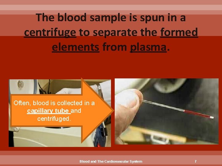 The blood sample is spun in a centrifuge to separate the formed elements from