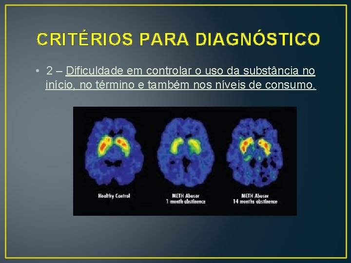 CRITÉRIOS PARA DIAGNÓSTICO • 2 – Dificuldade em controlar o uso da substância no