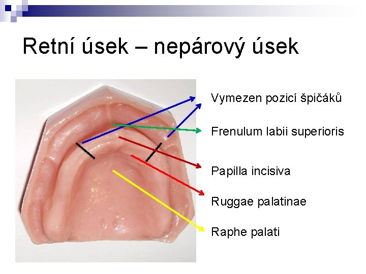Retní úsek – nepárový úsek Vymezen pozicí špičáků Frenulum labii superioris Papilla incisiva Ruggae