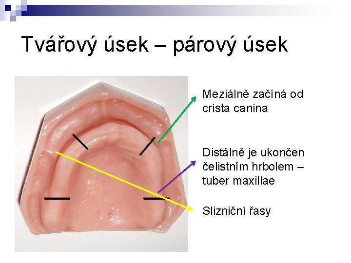 Tvářový úsek – párový úsek Meziálně začíná od crista canina Distálně je ukončen čelistním