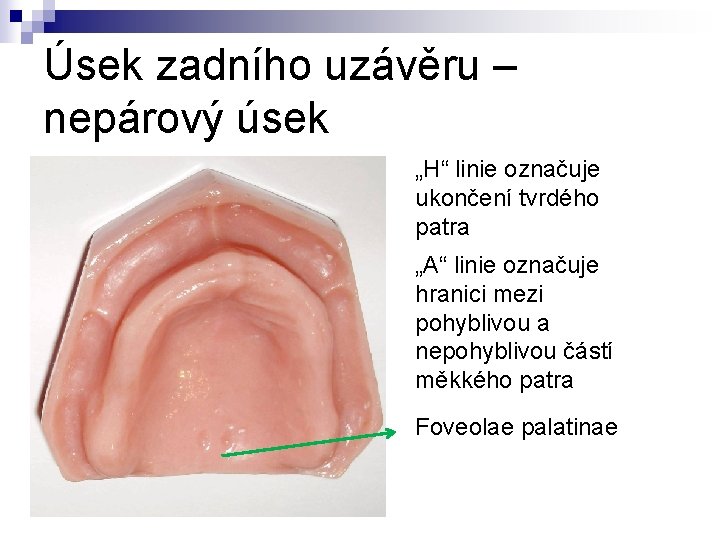 Úsek zadního uzávěru – nepárový úsek „H“ linie označuje ukončení tvrdého patra „A“ linie