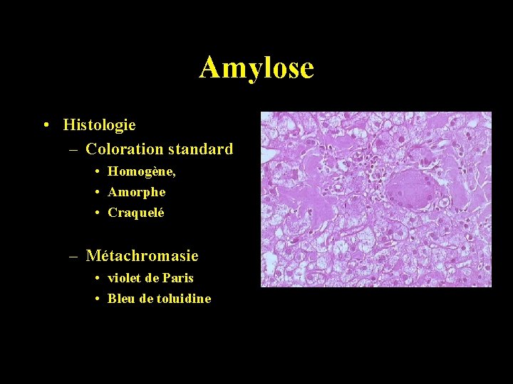 Amylose • Histologie – Coloration standard • Homogène, • Amorphe • Craquelé – Métachromasie