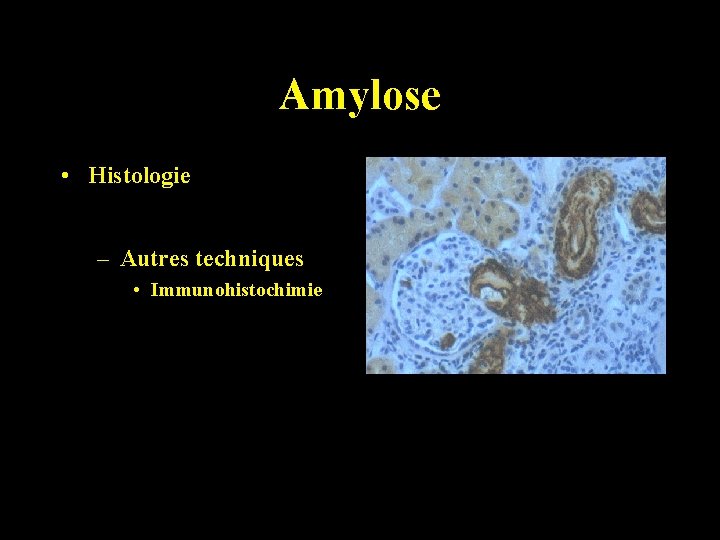 Amylose • Histologie – Autres techniques • Immunohistochimie 
