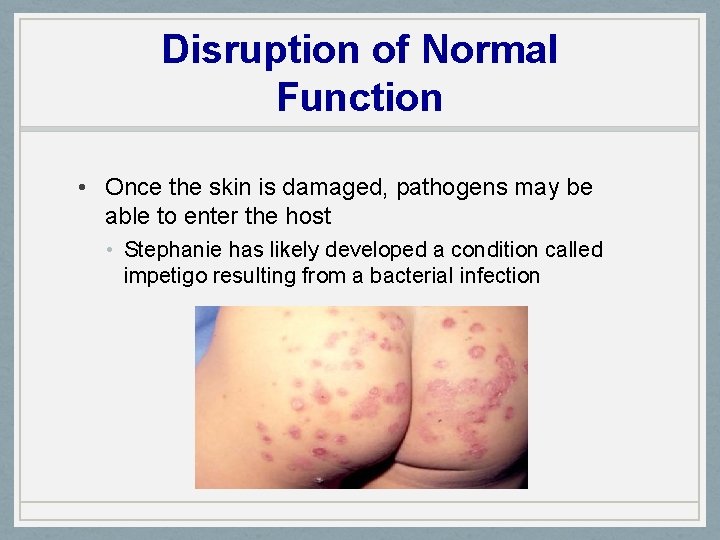 Disruption of Normal Function • Once the skin is damaged, pathogens may be able