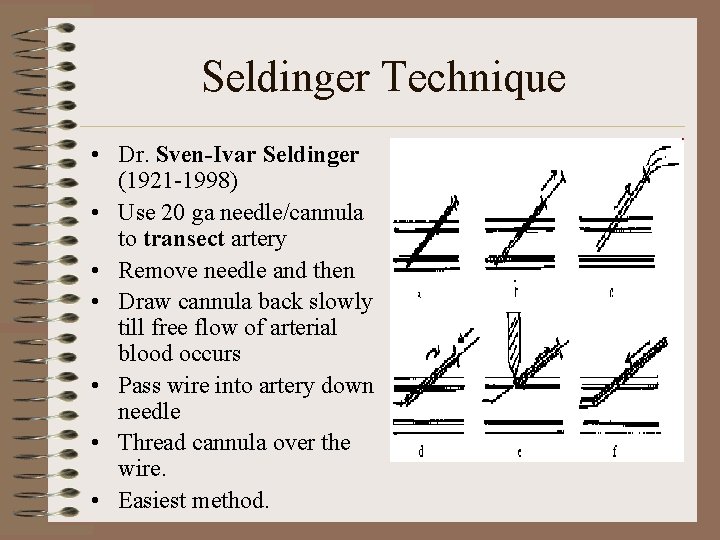 Seldinger Technique • Dr. Sven-Ivar Seldinger (1921 -1998) • Use 20 ga needle/cannula to